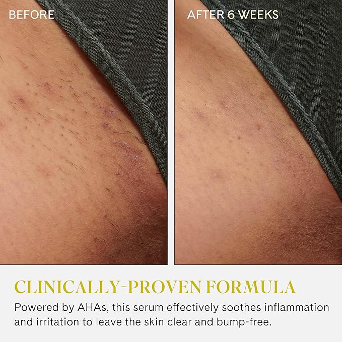 Fur Ingrown Eliminator Serum Rollerball Travel Size - Powerful Ingrown Hair Treatment Serum With AHAs and BHAs to Treat and Prevent Ingrown Hairs and Bumps, Hydrates and Soothes Irritated Skin - 10 ml